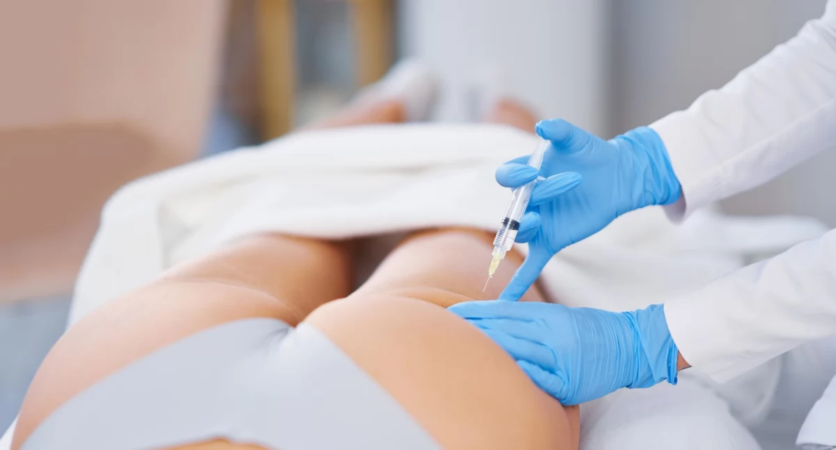 Informator / Materiały zewnętrzne , Modelowanie pośladków biostymulatorami innowacyjna metoda kształtowania sylwetki - zdjęcie, fotografia
