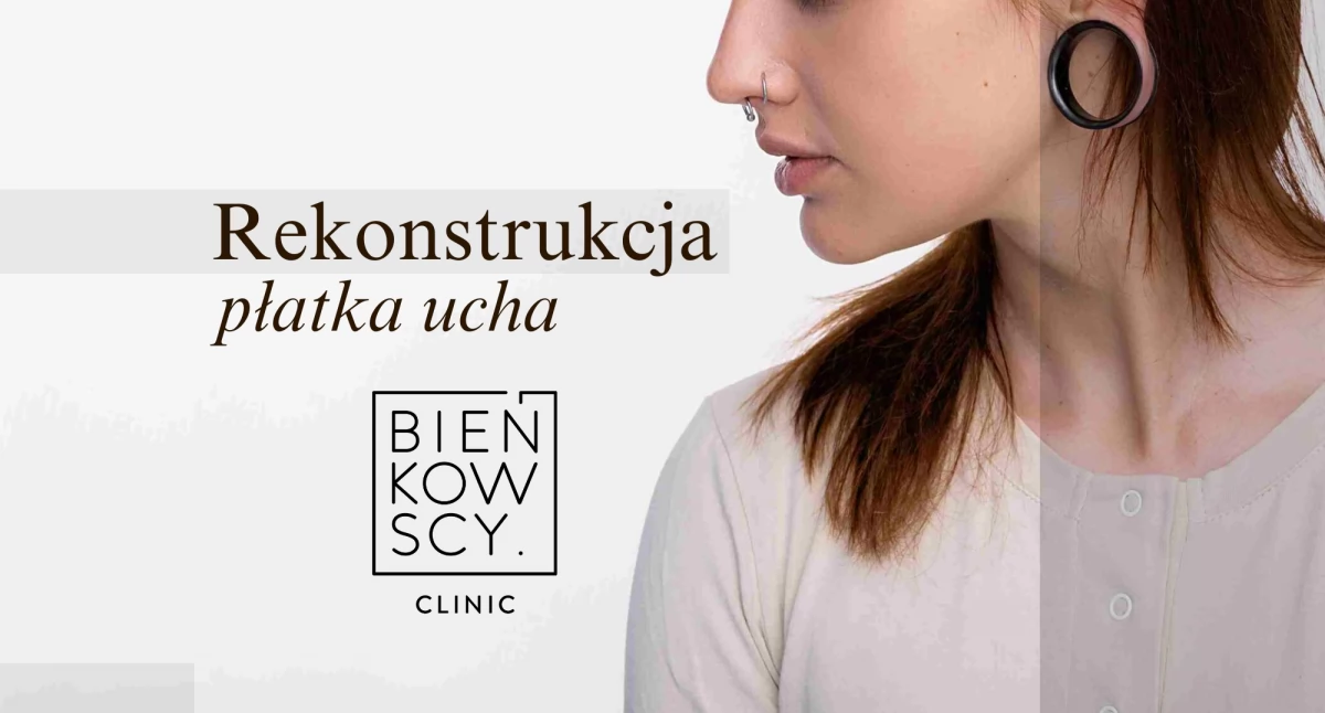 Informator / Materiały zewnętrzne , przywrócić naturalny wygląd tunelowych kolczykach Rekonstrukcja płatka - zdjęcie, fotografia
