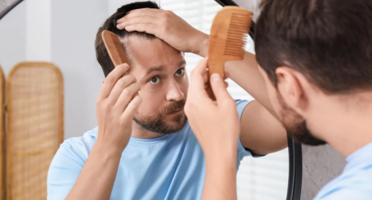 Informator / Materiały zewnętrzne , przeszczep włosów fanaberia luksus wpływie zabiegu samoocenę pewność siebie - zdjęcie, fotografia