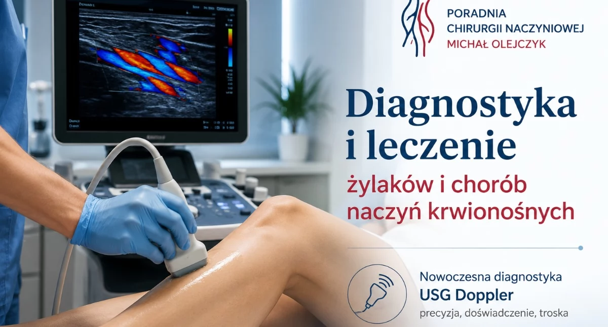 Informator / Materiały zewnętrzne , Diagnostyka leczenie żylaków chorób naczyń krwionośnych - zdjęcie, fotografia