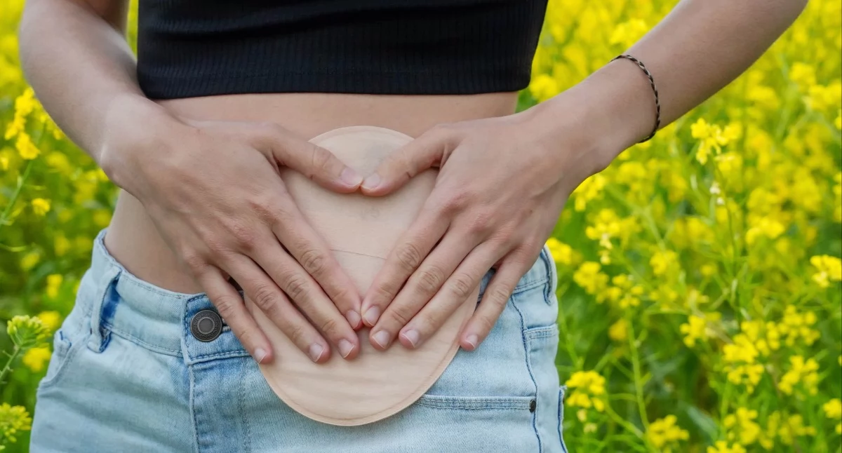 Informator / Materiały zewnętrzne , zmienia sprzęt stomijny Nowoczesne rozwiązania zwiększające komfort pacjentów - zdjęcie, fotografia