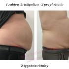 krolipoliza (4)