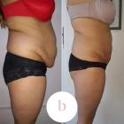bodyEwolution (3)