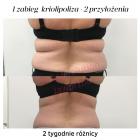 bodyevolu2
