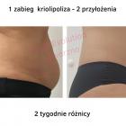 bodyevolu4
