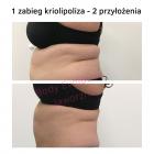 bodyevolu3
