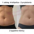 bodyevolu