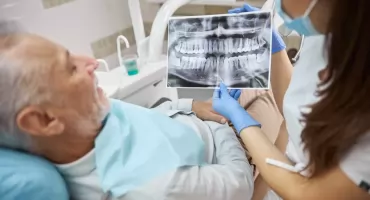 All-on-6 - odbudowa całego łuku zębowego na sześciu implantach