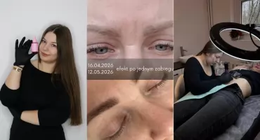 Czy stare, białe rozstępy można jeszcze skutecznie zmniejszyć? Nowoczesne podejście do regeneracji skóry