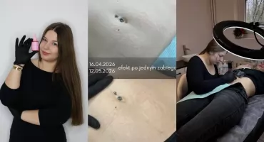 Czy stare, białe rozstępy można jeszcze skutecznie zmniejszyć? Nowoczesne podejście do regeneracji skóry